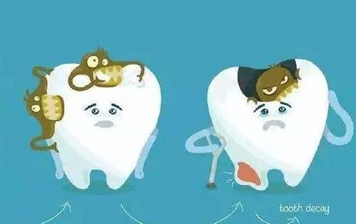 引起蛀牙的原因有哪些?怎么預(yù)防得蛀牙?