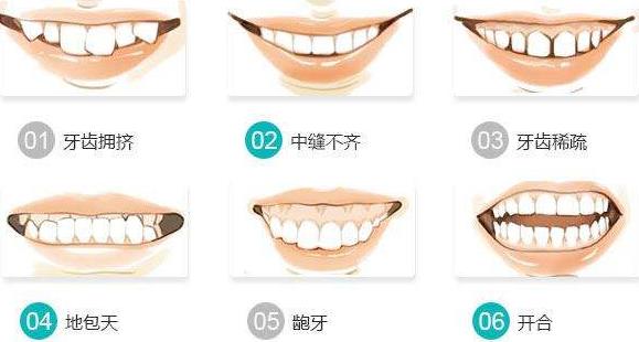牙齒松動是什么原因