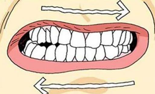 磨牙癥有哪些疾病分類?引起磨牙癥的原因有哪些?