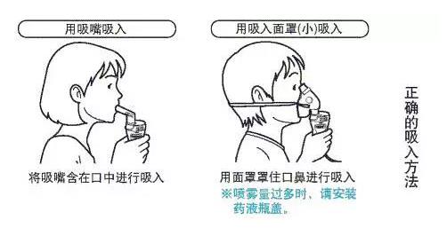 孩子咳嗽長期不好,會是肺炎嗎?霧化治療會好的快嗎?
