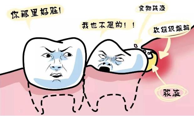 全民愛(ài)牙公益-智齒牙發(fā)炎有哪些炎癥呢
