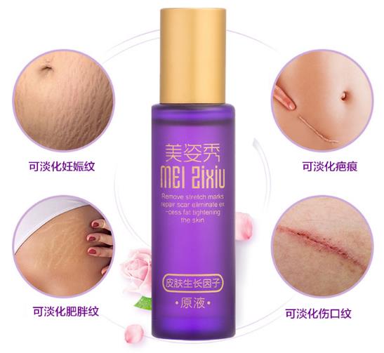 去妊娠紋最好的辦法,不要錯(cuò)過專業(yè)去紋產(chǎn)品