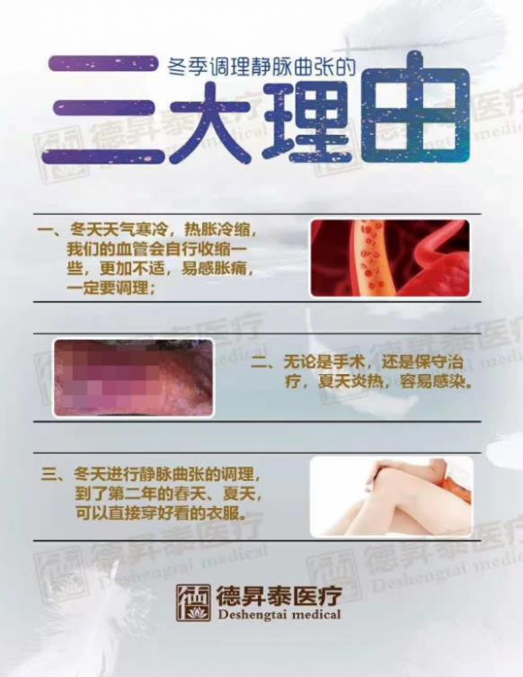 曲康健提醒靜脈曲張朋友們,這幾點(diǎn)一定要做好