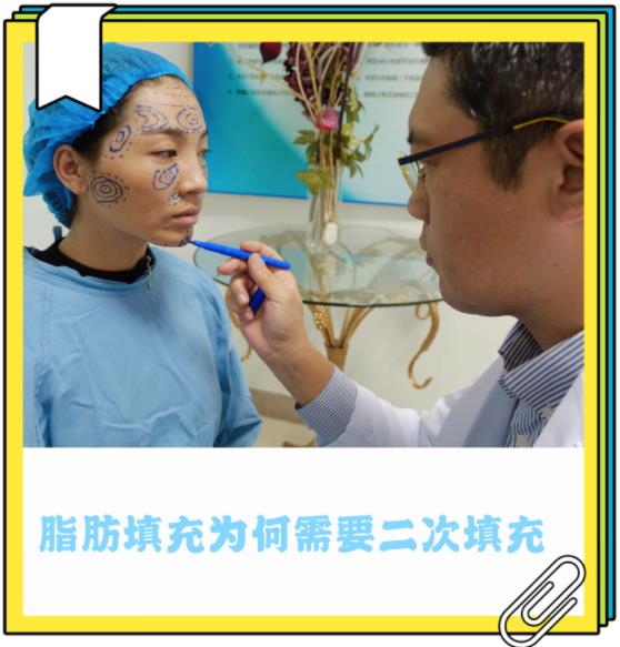 臉部脂肪填充效果如何 昆明吳氏嘉美整形醫(yī)院
