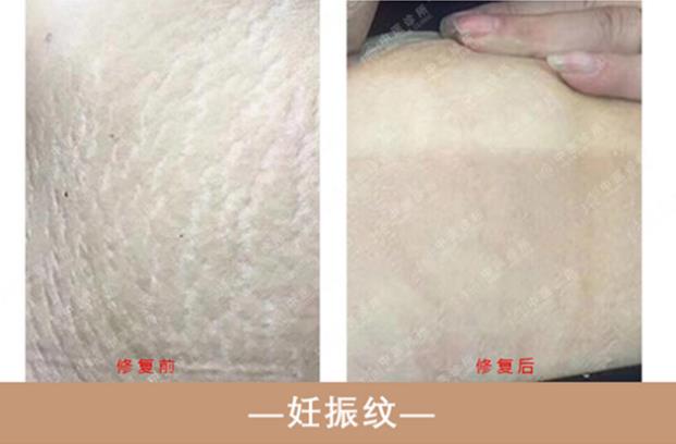 抖梵皙疤痕修護(hù)事業(yè)萬億市場來襲