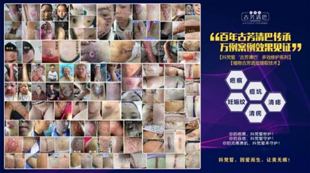 抖梵皙疤痕修護(hù)事業(yè)萬億市場來襲