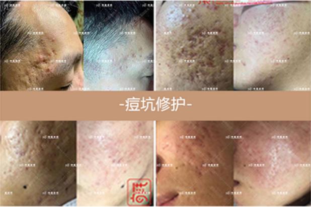 抖梵皙疤痕修護(hù)事業(yè)萬億市場來襲