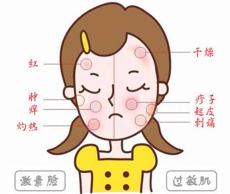 過敏了臉紅腫癢怎么辦?朵嘉濃真的能修復(fù)嗎?