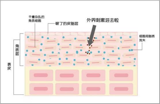 過敏了臉紅腫癢怎么辦?朵嘉濃真的能修復(fù)嗎?