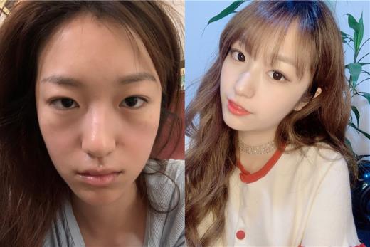 巧致整形內(nèi)吸祛眼袋 以自然勝天然 跨越代溝 還你“睛”彩雙眸