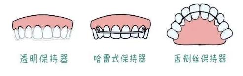 為什么正畸結(jié)束了,一定要戴保持器——全民矯牙公益行動(dòng)
