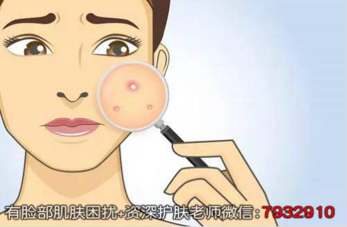 淡斑祛痘印哪個(gè)產(chǎn)品好?朵嘉濃怎么樣?
