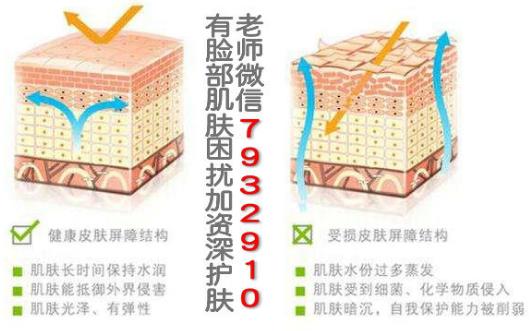 我的臉過敏了怎么辦?臉過敏后毛孔粗大如何解決?
