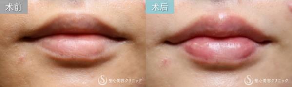 日式整形醫(yī)生解析:如何擁有日本女明星般的日式精致臉?