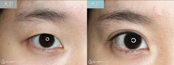 日式整形醫(yī)生解析:如何擁有日本女明星般的日式精致臉?