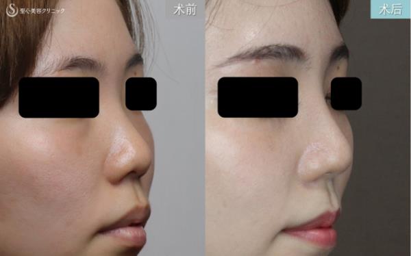 日式整形醫(yī)生解析:如何擁有日本女明星般的日式精致臉?