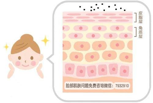 激素臉怎么辦能好嗎?過敏性皮炎和激素臉有什么區(qū)別?