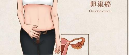 香港仁生專家談:這三大癌癥一旦發(fā)現(xiàn)就是晚期