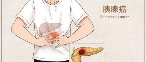 香港仁生專家談:這三大癌癥一旦發(fā)現(xiàn)就是晚期