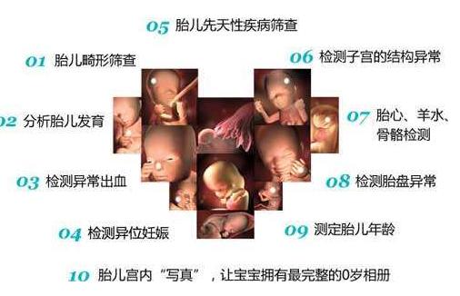 【四維】石家莊港大婦產(chǎn)醫(yī)院靠譜嗎?胎兒宮內(nèi)