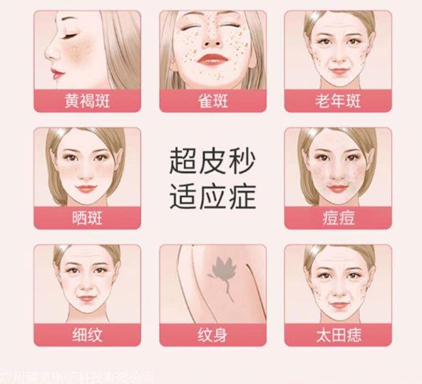 超皮秒激光在眼周年輕化的作用——石榴醫(yī)療美容醫(yī)院李月萍院長(zhǎng)