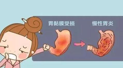 中醫(yī)胃腸專家徐崇偉,慢性胃炎的中醫(yī)辨證