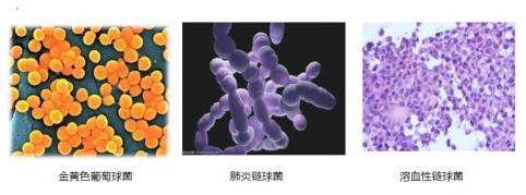 抗病毒顆粒的作用及功效有哪些?看完這篇你就懂!