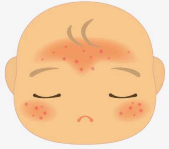 濕疹怎么治療有什么好的方法嗎?走了很多彎路終于找到救星!