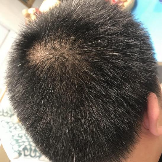黑芝麻怎么吃能生發(fā),吃多久可以白發(fā)變黑