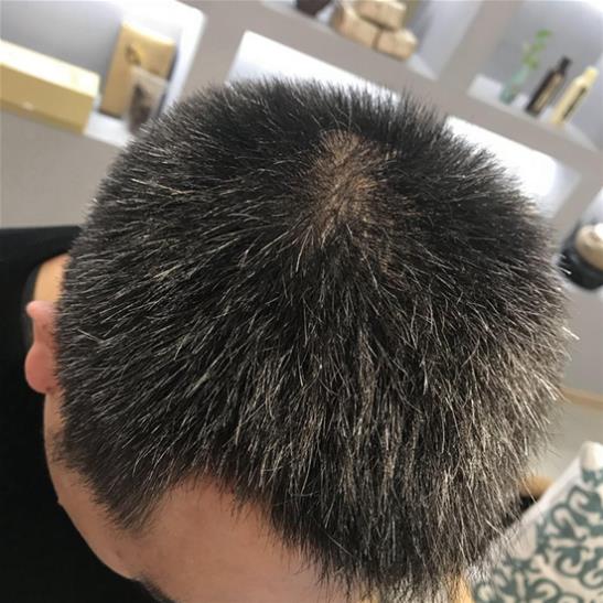 原來脫發(fā)白頭發(fā)和它有關(guān),這個(gè)東西能讓白發(fā)變黑!