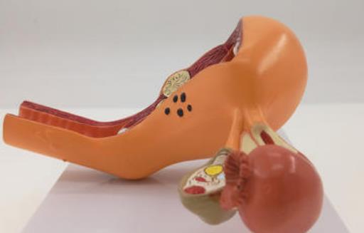 子宮肌瘤有哪些分類?子宮肌瘤有哪些危害?