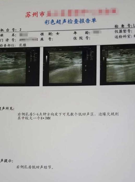 【分享】讓我痛苦多年的乳腺增生竟然這么輕松就好了
