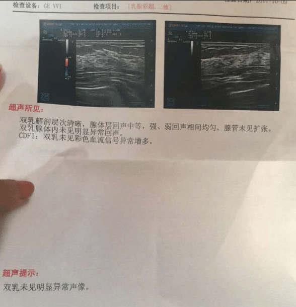 【分享】讓我痛苦多年的乳腺增生竟然這么輕松就好了