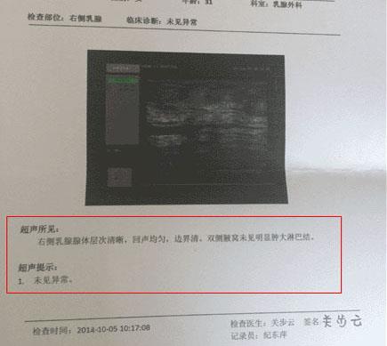 早知道乳腺增生這么容易就能好 我還TMD做什么手術(shù)!胸部都割爛了!