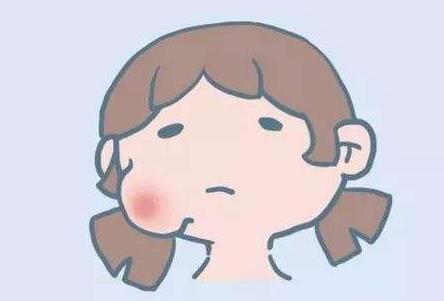 如何預(yù)防流行性腮腺炎?流行性腮腺炎的癥狀是什么