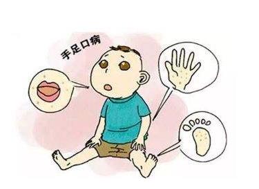 如何預(yù)防手足口?手足口病的癥狀是什么