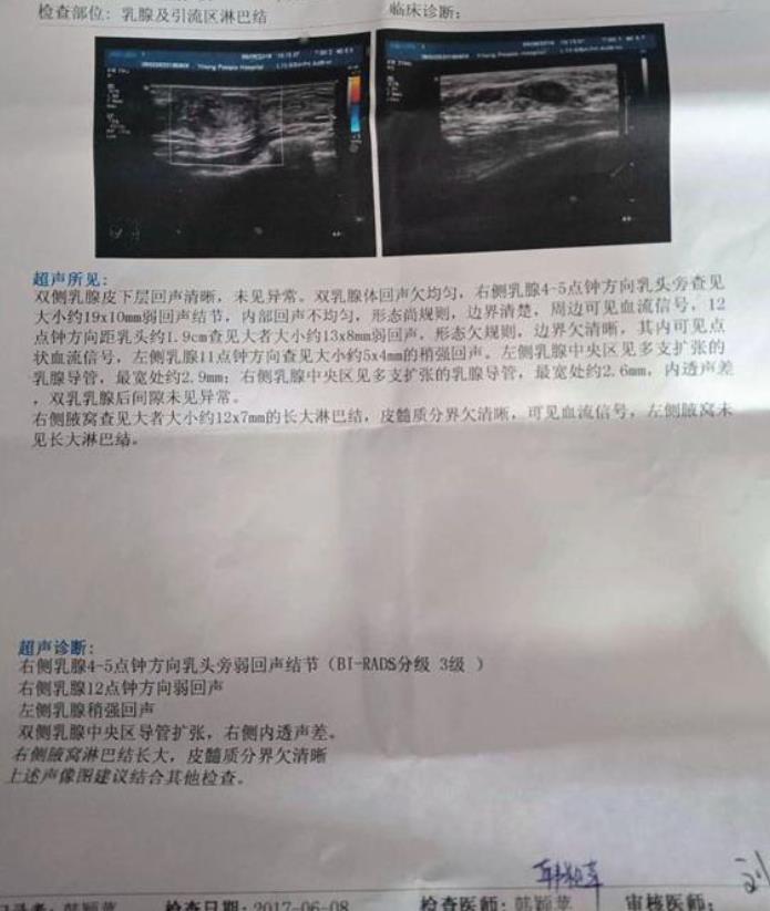 乳腺腫塊應(yīng)怎么治療?康蓓詩乳康冷敷貼輕松康復(fù)不用愁
