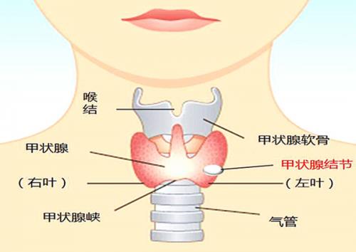 太乙堂馬健:治療甲狀腺結(jié)節(jié),宜從肝脾入手