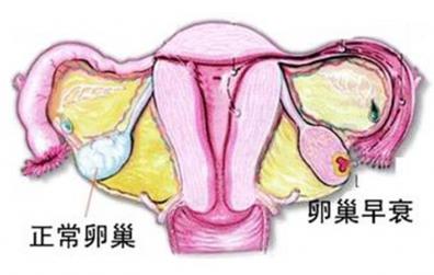 貴州睿德邇婦產(chǎn)醫(yī)院:熬夜玩手機(jī)、節(jié)食減肥,小心年紀(jì)輕輕卵巢早衰