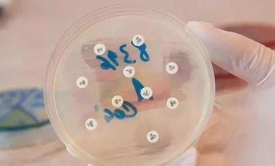 乳頭濕疹有哪些癥狀?為什么會(huì)患乳頭濕疹?