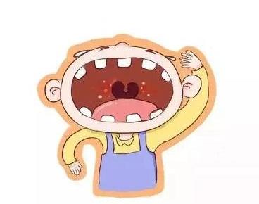皰疹性口炎會(huì)傳染嗎?如何預(yù)防皰疹性口炎