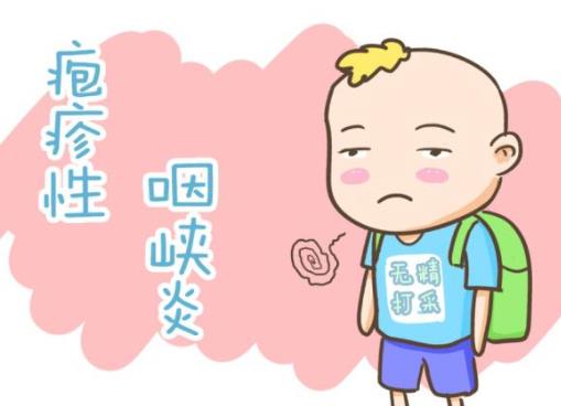 皰疹性咽峽炎的病因是什么?皰疹性咽峽炎的癥狀