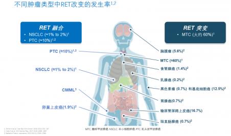 兩個(gè)月咳出腫瘤組織,高響應(yīng)率非小細(xì)胞肺癌靶向藥將改變患者命運(yùn)