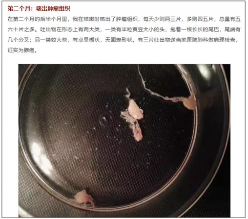 兩個(gè)月咳出腫瘤組織,高響應(yīng)率非小細(xì)胞肺癌靶向藥將改變患者命運(yùn)