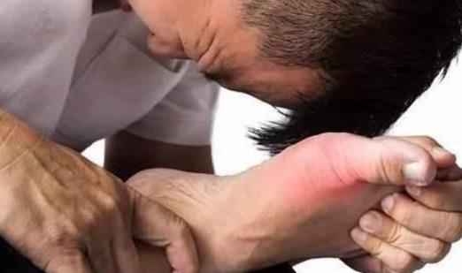 什么是假性痛風?假性痛風做哪些檢查?