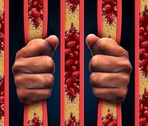 靜脈炎的治療方法是什么?靜脈炎能自己好嗎