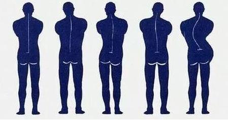 脊柱側(cè)彎的原因是什么?如何及早發(fā)現(xiàn)脊柱側(cè)彎