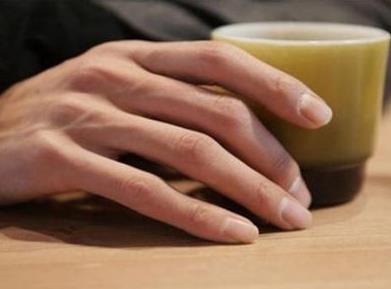 白斑病會傳染人嗎?白斑病的癥狀表現(xiàn)