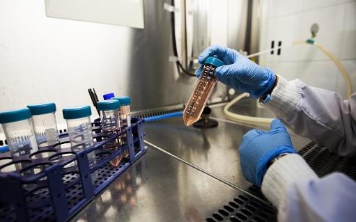 血性腹水需要注意什么?血性腹水做哪些檢查?