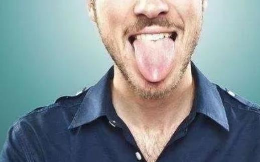 哪些人易患舌炎?舌炎需要做哪些檢查?